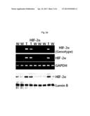 CARTILAGE-SPECIFIC HIF-2ALPHA TRANSGENIC MOUSE AS AN ANIMAL MODEL FOR     ARTHRITIS, AND USE THEREOF diagram and image