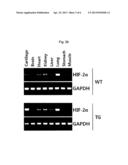 CARTILAGE-SPECIFIC HIF-2ALPHA TRANSGENIC MOUSE AS AN ANIMAL MODEL FOR     ARTHRITIS, AND USE THEREOF diagram and image