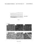NOVEL ANTIBODY FOR THE DIAGNOSIS AND/OR PROGNOSIS OF CANCER diagram and image
