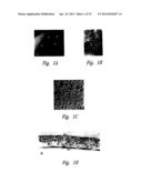 ANTI-ANGIOGENIC COMPOSITIONS AND METHODS OF USE diagram and image