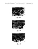 ANTI-ANGIOGENIC COMPOSITIONS AND METHODS OF USE diagram and image