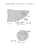 ANTI-ANGIOGENIC COMPOSITIONS AND METHODS OF USE diagram and image