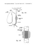 ANTI-ANGIOGENIC COMPOSITIONS AND METHODS OF USE diagram and image