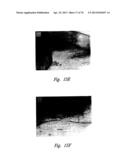 ANTI-ANGIOGENIC COMPOSITIONS AND METHODS OF USE diagram and image