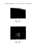 ANTI-ANGIOGENIC COMPOSITIONS AND METHODS OF USE diagram and image