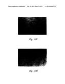 ANTI-ANGIOGENIC COMPOSITIONS AND METHODS OF USE diagram and image