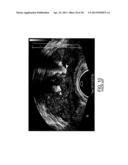 LOW-COST DEVICE FOR C-SCAN PHOTOACOUSTIC IMAGING diagram and image