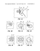 Port System and Methods diagram and image