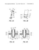 Port System and Methods diagram and image