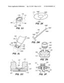 Port System and Methods diagram and image