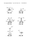 Port System and Methods diagram and image