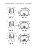 Port System and Methods diagram and image