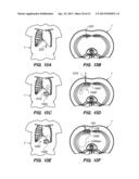 Port System and Methods diagram and image