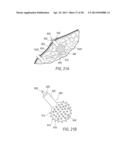 SURGICAL ACCESS SYSTEM WITH NAVIGATION ELEMENT AND METHOD OF USING SAME diagram and image