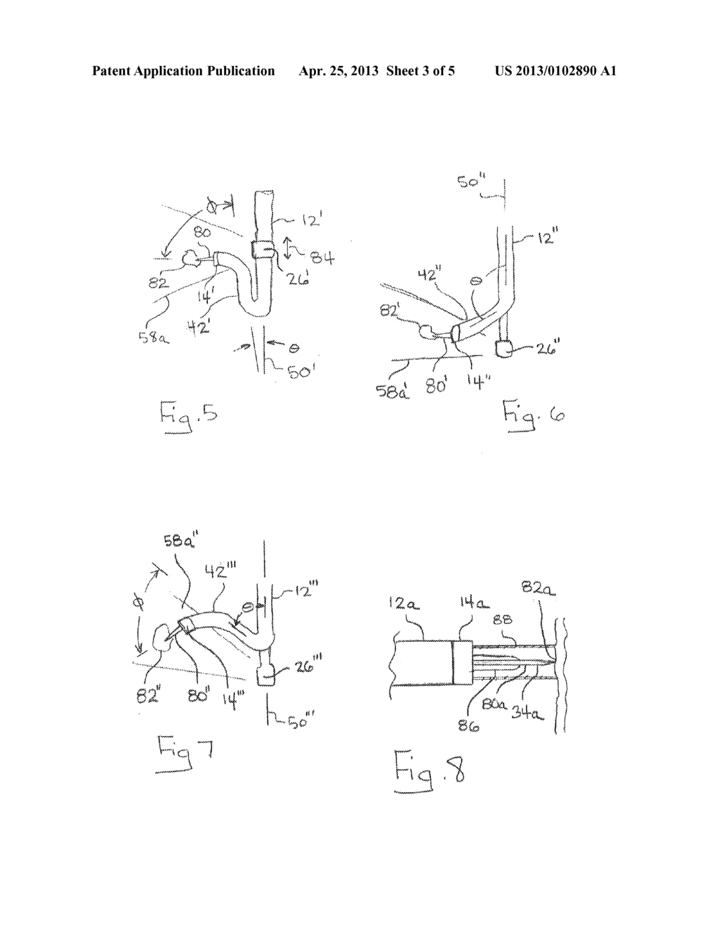 System and Method for Visualizing Catheter Placement in a Vasculature - diagram, schematic, and image 04