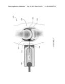 CONTROLLED NEEDLE-FREE TRANSPORT diagram and image