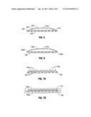 Implantable Film/Mesh Composite diagram and image