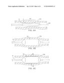 Cryosurgical Fluid Supply diagram and image