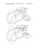 REFLECTANCE-FACILITATED ULTRASOUND TREATMENT AND MONITORING diagram and image