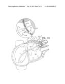 REFLECTANCE-FACILITATED ULTRASOUND TREATMENT AND MONITORING diagram and image