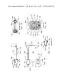 PROCEDURE FOR REPAIRING FOOT INJURY diagram and image