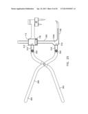 PROCEDURE FOR REPAIRING FOOT INJURY diagram and image