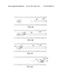 MEDICAL RETRIEVAL DEVICE diagram and image