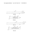 DISCECTOMY DEVICES AND RELATED METHODS diagram and image