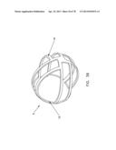 METHOD AND APPARATUS FOR RESTRICTING FLOW THROUGH AN OPENING IN THE SIDE     WALL OF A BODY LUMEN, AND/OR FOR REINFORCING A WEAKNESS IN THE SIDE WALL     OF A BODY LUMEN, WHILE STILL MAINTAINING SUBSTANTIALLY NORMAL FLOW     THROUGH THE BODY LUMEN diagram and image