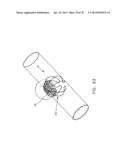 METHOD AND APPARATUS FOR RESTRICTING FLOW THROUGH AN OPENING IN THE SIDE     WALL OF A BODY LUMEN, AND/OR FOR REINFORCING A WEAKNESS IN THE SIDE WALL     OF A BODY LUMEN, WHILE STILL MAINTAINING SUBSTANTIALLY NORMAL FLOW     THROUGH THE BODY LUMEN diagram and image