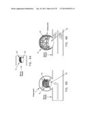 METHOD AND APPARATUS FOR RESTRICTING FLOW THROUGH AN OPENING IN THE SIDE     WALL OF A BODY LUMEN, AND/OR FOR REINFORCING A WEAKNESS IN THE SIDE WALL     OF A BODY LUMEN, WHILE STILL MAINTAINING SUBSTANTIALLY NORMAL FLOW     THROUGH THE BODY LUMEN diagram and image