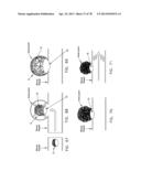 METHOD AND APPARATUS FOR RESTRICTING FLOW THROUGH AN OPENING IN THE SIDE     WALL OF A BODY LUMEN, AND/OR FOR REINFORCING A WEAKNESS IN THE SIDE WALL     OF A BODY LUMEN, WHILE STILL MAINTAINING SUBSTANTIALLY NORMAL FLOW     THROUGH THE BODY LUMEN diagram and image