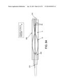 METHOD AND APPARATUS FOR RESTRICTING FLOW THROUGH AN OPENING IN THE SIDE     WALL OF A BODY LUMEN, AND/OR FOR REINFORCING A WEAKNESS IN THE SIDE WALL     OF A BODY LUMEN, WHILE STILL MAINTAINING SUBSTANTIALLY NORMAL FLOW     THROUGH THE BODY LUMEN diagram and image