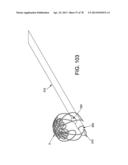 METHOD AND APPARATUS FOR RESTRICTING FLOW THROUGH AN OPENING IN THE SIDE     WALL OF A BODY LUMEN, AND/OR FOR REINFORCING A WEAKNESS IN THE SIDE WALL     OF A BODY LUMEN, WHILE STILL MAINTAINING SUBSTANTIALLY NORMAL FLOW     THROUGH THE BODY LUMEN diagram and image