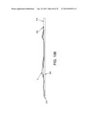 METHOD AND APPARATUS FOR RESTRICTING FLOW THROUGH AN OPENING IN THE SIDE     WALL OF A BODY LUMEN, AND/OR FOR REINFORCING A WEAKNESS IN THE SIDE WALL     OF A BODY LUMEN, WHILE STILL MAINTAINING SUBSTANTIALLY NORMAL FLOW     THROUGH THE BODY LUMEN diagram and image