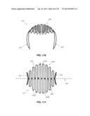 METHOD AND APPARATUS FOR RESTRICTING FLOW THROUGH AN OPENING IN THE SIDE     WALL OF A BODY LUMEN, AND/OR FOR REINFORCING A WEAKNESS IN THE SIDE WALL     OF A BODY LUMEN, WHILE STILL MAINTAINING SUBSTANTIALLY NORMAL FLOW     THROUGH THE BODY LUMEN diagram and image