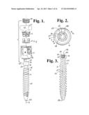 Polyaxial bone anchor with pop-on shank, friction fit retainer and lateral     alignment feature diagram and image