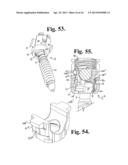 Polyaxial bone anchor with pop-on shank, friction fit retainer and lateral     alignment feature diagram and image