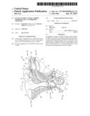 ELONGATE IMPLANTABLE CARRIER MEMBER HAVING AN EMBEDDED STIFFENER diagram and image