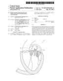 PERCUTANEOUS TRANSVALVULAR INTRAANNULAR BAND FOR MITRAL VALVE REPAIR diagram and image