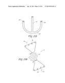 PERCUTANEOUS TRANSVALVULAR INTRAANNULAR BAND FOR MITRAL VALVE REPAIR diagram and image