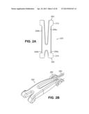 SCLERAL PROSTHESIS FOR TREATING PRESBYOPIA AND OTHER EYE DISORDERS AND     RELATED DEVICES AND METHODS diagram and image