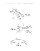 SCLERAL PROSTHESIS FOR TREATING PRESBYOPIA AND OTHER EYE DISORDERS AND     RELATED DEVICES AND METHODS diagram and image