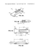 SCLERAL PROSTHESIS FOR TREATING PRESBYOPIA AND OTHER EYE DISORDERS AND     RELATED DEVICES AND METHODS diagram and image