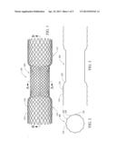 COATED STENT diagram and image