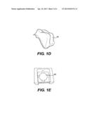 METHOD AND SYSTEM FOR FABRICATING A DENTAL COPING, AND A COPING FABRICATED     THEREBY diagram and image