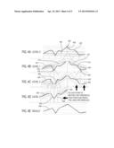 Computing Predicted Data According to Weighted Peak Preservation and Time     Distance Biasing diagram and image