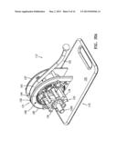 TISSUE PROSTHESIS PROCESSING TECHNOLOGY diagram and image