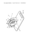 TISSUE PROSTHESIS PROCESSING TECHNOLOGY diagram and image