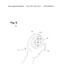 Method For Constructing A Blood Glucose Sampling Device diagram and image